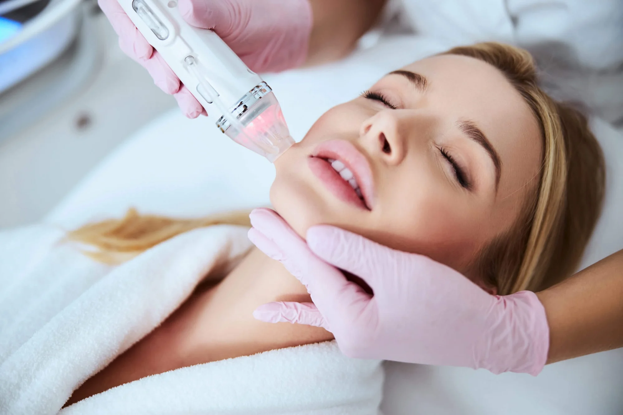 Microneedling | Envi Aesthetics | Aldie, Virginia