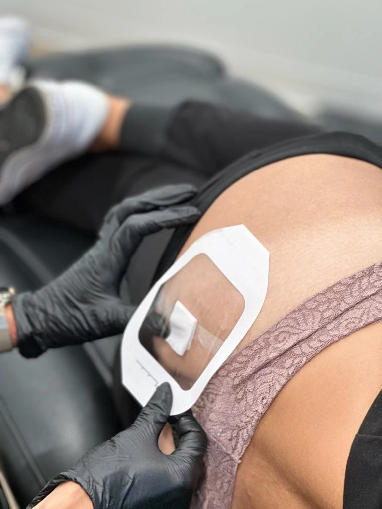 A patient receives hormone replacement therapy in Aldie, VA.