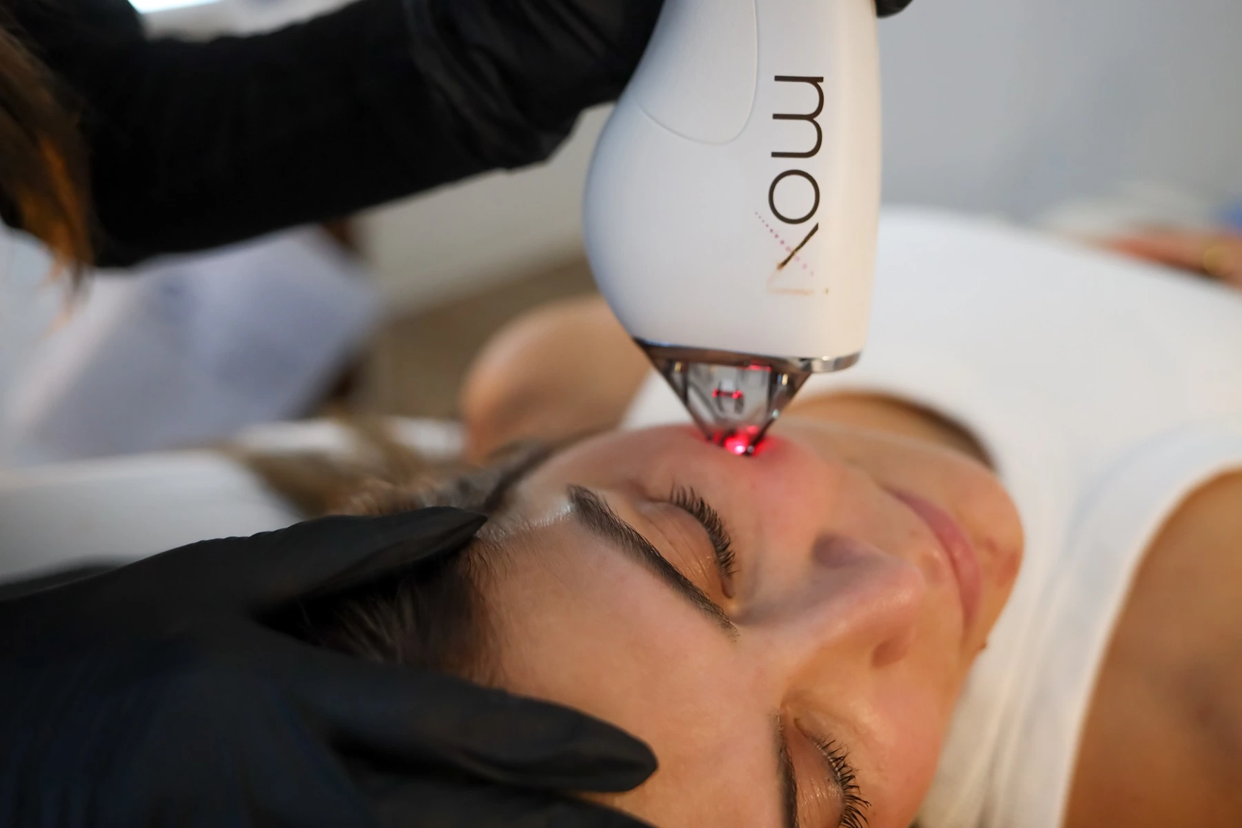 Laser Services in Aldie, VA | Envi Aesthetics