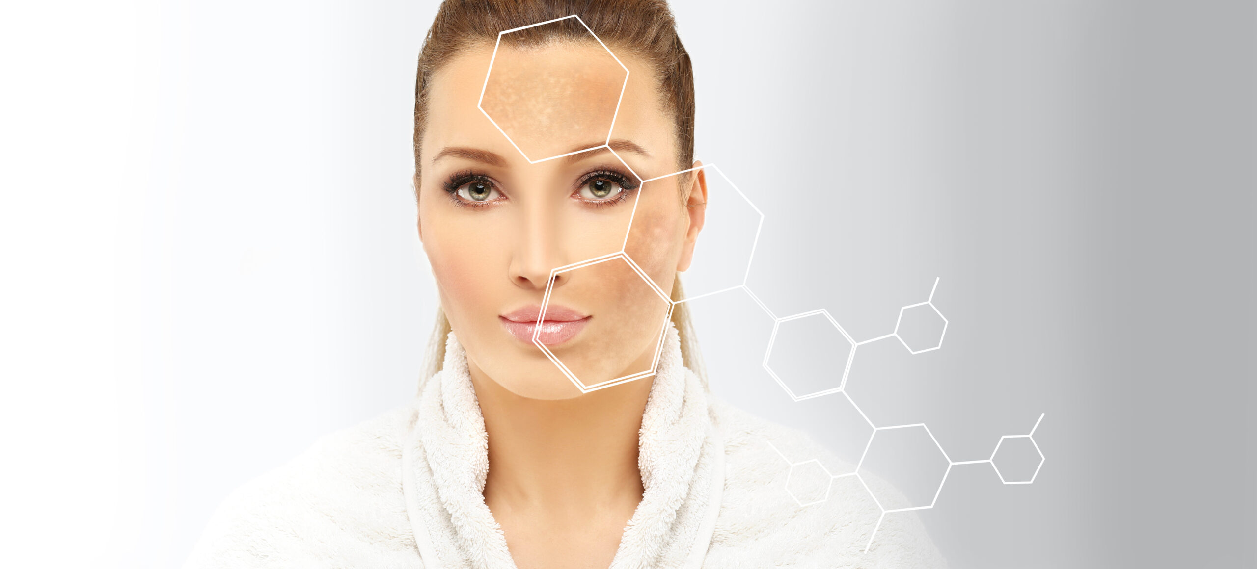 Chemical Peels for Stubborn Pigmentation | Envi Aesthetics in Aldie, VA
